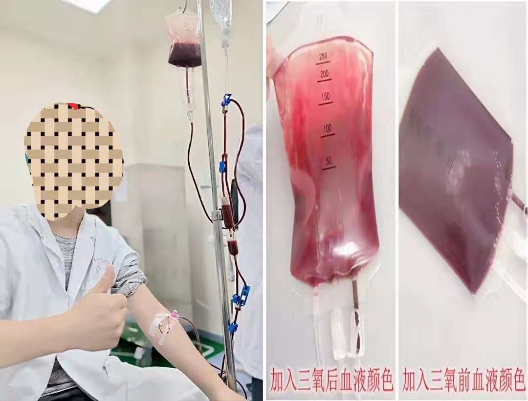 【技术推广】三氧大自血疗法
